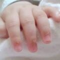 寶寶的指甲會「說話」，遇到這4種狀況不能忽視，寶媽來看看！