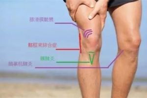 膝關節常見疾病，你知多少？