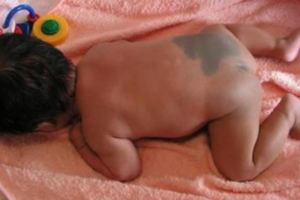 亞洲的小孩一出生很多都有「胎記」，其中的原因居然比大家想的更厲害！