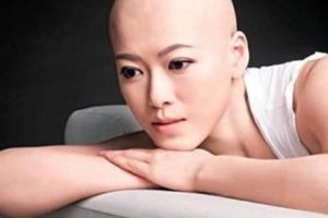 TVB的「甘草」女藝人曾因癌症多次化療如今與~~~~