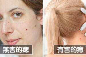 低敏感化妝品根本不萬用　14個「越做皮膚越糟」的美容迷思