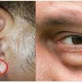 專家提醒：6種皺紋，是健康報警，不可忽視，耳垂皺紋最危險。