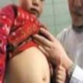 5歲男童竟像懷孕般「肚子出奇的大」，醫生檢查嚇傻：裡面真的有人！