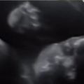 準媽咪興奮照4D超音波　28週寶寶突然「轉頭做出超Q手勢」醫生也嗨翻：我有看錯嗎