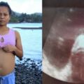 真的懷了魚寶寶嗎？菲律賓少女疑跟海中異形「亂來」致肚子變大，超音波發現「魚寶寶」！