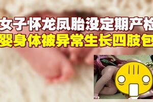 夫妻喜迎龍鳳胎　孩子出生嚇著了醫生