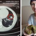 澳洲醫生判她癌症晚期，她卻在中國治好了