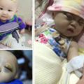 十月寶寶腫瘤壓迫雙目失明，媽媽不忍孩子受苦要求安樂死