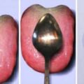 這個超簡單方法可以讓你在1分鐘內確認身體健康狀況，拿湯匙刮一刮舌頭，根據上面的東西就知道你哪裡有病！