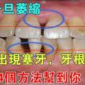 牙齦一旦萎縮，就會出現塞牙，牙根疼痛，4個方法幫到你