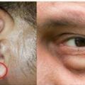 專家提醒：這6種皺紋是健康報警，不可忽視！耳垂皺紋最危險！
