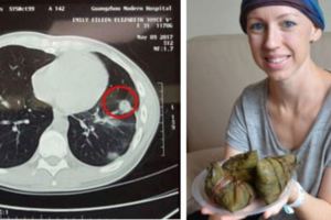 澳洲醫生判她癌症晚期，她卻在中國治好了