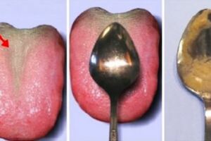 這個超簡單方法可以讓你在1分鐘內確認身體健康狀況，拿湯匙刮一刮舌頭，根據上面的東西就知道你哪裡有病！