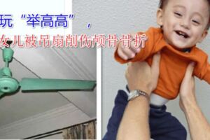 擔心的事情發生了！父親玩「舉高高」，3歲女兒被吊扇削傷顱骨骨折