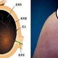 隱形眼鏡「最新突破」，國外專家竟說視力可以．．．．根本就可以讓近視消失於地表呀~