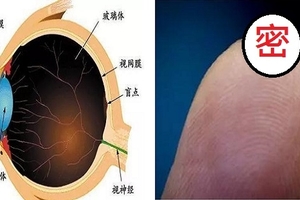 隱形眼鏡「最新突破」，國外專家竟說視力可以．．．．根本就可以讓近視消失於地表呀~