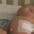 10個月大女嬰體內現12根鋼針，鋼針被取出有驚無險，女嬰恢復健康