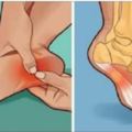 腳的大拇指好痛代表有危機？按一按腳底穴道就知道的3個危險訊息...大拇指可能特別危險呦！