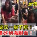 【恐怖報復！】逛街被踩一腳不爽！女慘遭砍到滿臉血！