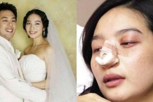 剛結婚被丈夫砍掉手指，如今又被打流產，網友：娛樂圈最慘女星！