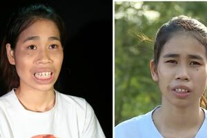 醜女整容變天仙，親媽不認還讓她滾