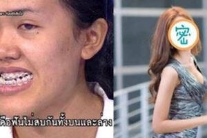 泰國醜女哭訴只想變正常人，改造完變「混血感天菜正妹」網友驚呆！