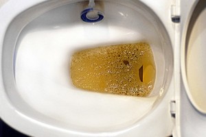 太可怕了！尿尿出現「泡泡」時千萬要提高警覺！男人尿分叉了就代表...，女人排尿前得先做這件事！