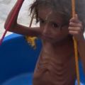 戰爭至今未停！520萬孩童找不到下一餐在哪　葉門陷入嚴重飢荒！