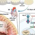 負載 Galunisertib 的GelMA微針貼片，用於心肌梗塞後心臟修復