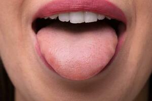 為什麼中醫問診都要看舌頭？原來「舌診」有這用處