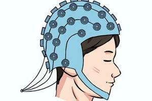 腦電圖是什麼—就是給癲癇病友的腦子裝個監控