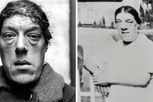 為養活4子女!媽媽忍痛參加「選醜大賽」奪冠 「年輕時美貌曝光」背後經歷超鼻酸 為養活4子女!媽媽忍痛參加「選醜大賽」奪冠 「年輕時美貌曝光」背後經歷超鼻酸