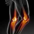 50歲以上，都是膝蓋的毛病《治養膝關節，非常受用的「伸膝操」，消除上下樓疼痛，疏散積液！