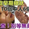 「尿毒症」早期癥狀10個人中6個都有，快自查！不然只能「洗腎」了！千萬別等無藥可治！