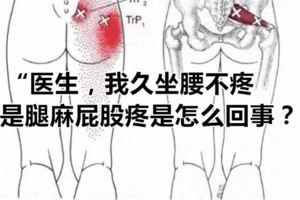 「醫生，我久坐腰不疼，但是腿麻屁股疼是怎麼回事？」