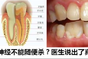 牙神經不能隨便殺？醫生說出了真相
