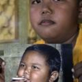 曾经一天抽40支烟的印尼2岁小烟鬼，他现在的生活状况