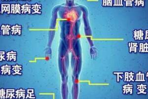 45歲1天透析5次還住進ICU，糖尿病不控制血糖的惡果