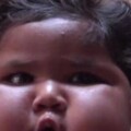 印度8個月大女嬰體重34斤，每天不停的吃，身體胖成了米其林
