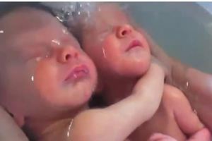剛出生雙胞胎兄弟被護士抱去洗澡，哥哥全程的表現萌翻，暖哭大家