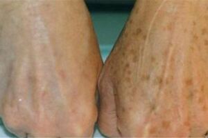 養胃吃它，祛斑、除口臭必吃它，失眠、補腎更要吃它！