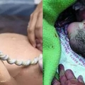 生出孩子、剪斷臍帶的那瞬間，產婦突然一聲咳嗽！沒想到最後竟然....