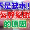 終於找到嘴唇老是「乾裂脫皮」的原因！原來不是缺水，應該要「這樣做」....趕快收藏吧