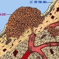 請多喝熱開水：因為癌像感冒一樣普遍： 日本新發現殺癌細胞的方法，原來就是常喝這個！！
