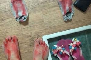 韓國正妹穿2.44美元大陸拖鞋...5分鐘內腳流血不止竟然變殘廢！