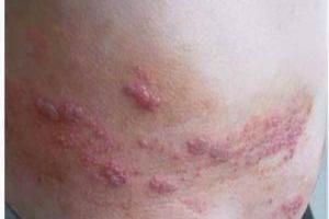 【 生蛇的藥方】請分享出去, 功德無量！