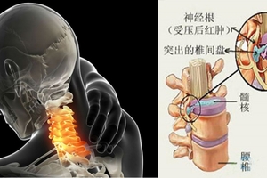 又一個不缺錢的死了！死因竟然是這種病！快把這幾招學起來保命啊！