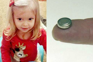 2歲女兒突然吐血發藍醫生找不出死因，最後才在她胃里發現這東西