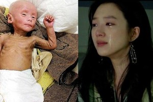 5歲的孩子竟然變成了「老頭」…只因為爺爺每天讓他喝這個東西！媽媽在醫院不停地流眼淚…