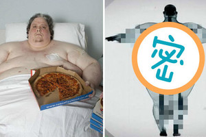 醫生宣判這名重達445公斤男子「再不減肥2年內就會死」，替他照了X光後...醫生看到照片也嚇到目瞪口呆！